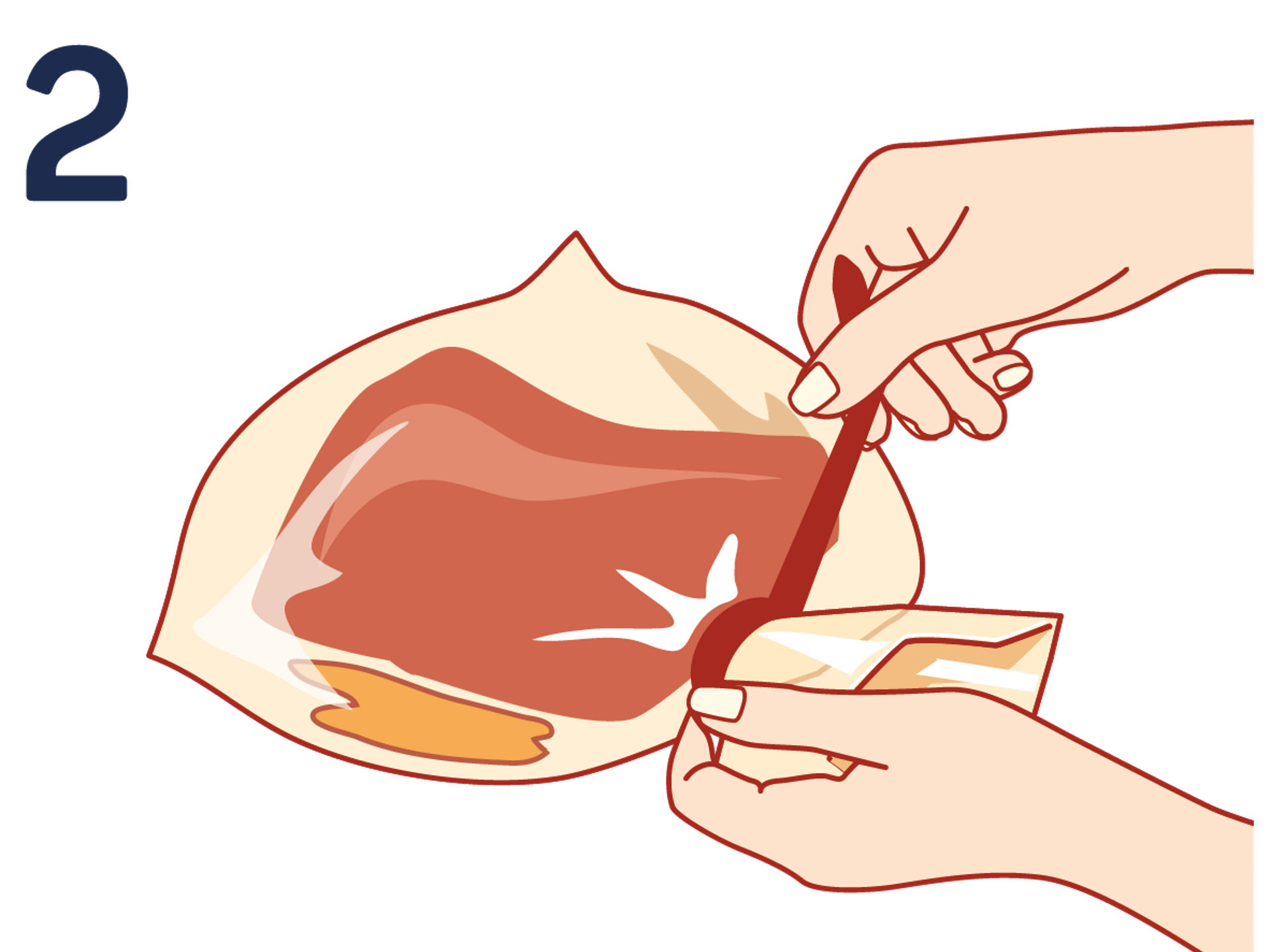 Fermeture du sac de cuisson à l'aide du lien de fermeture