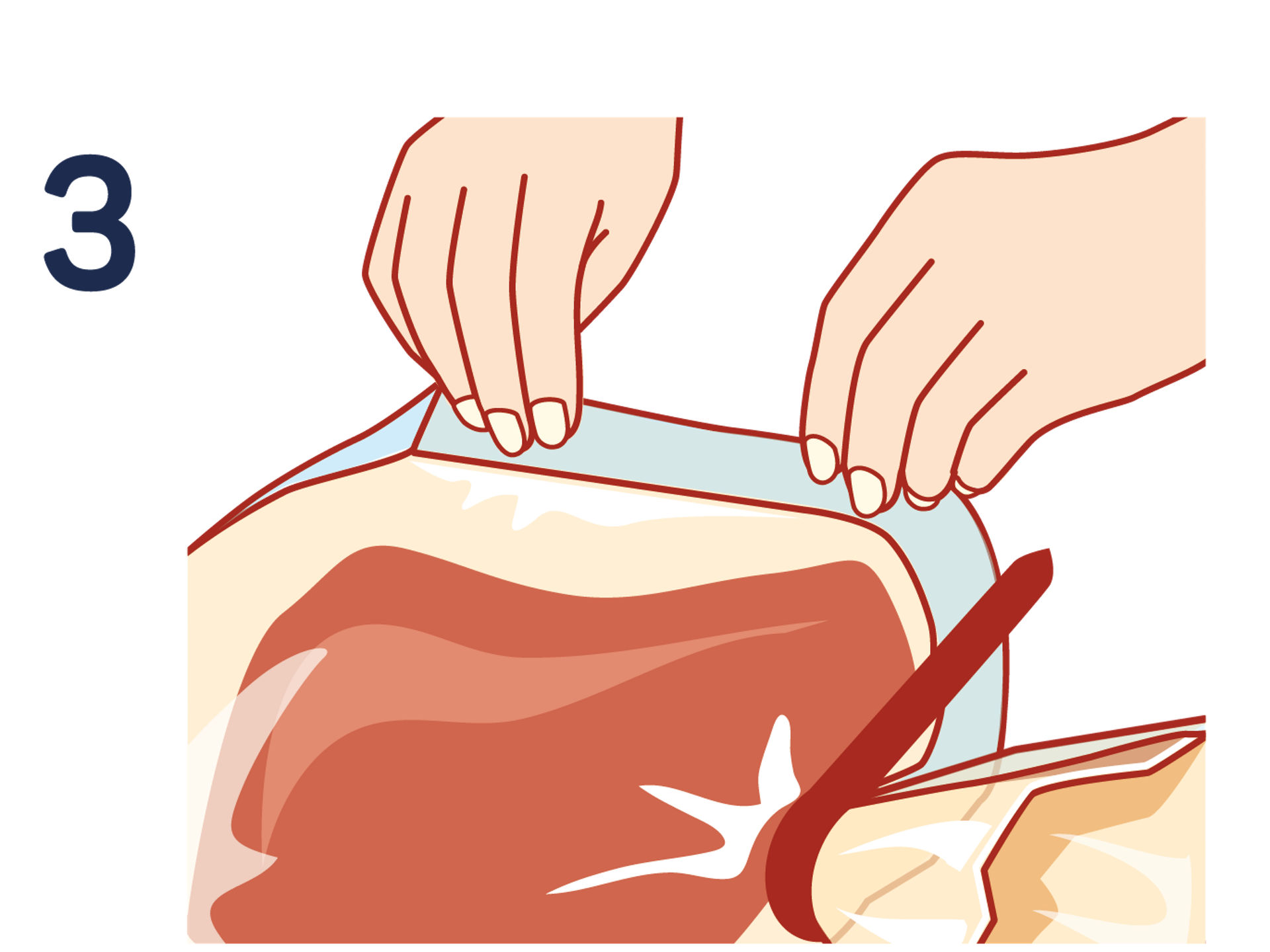  Récupération du sac après cuisson en attrapant le bord froid