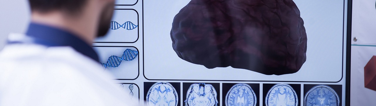 implantes grafeno tratamiento de enfermedades neurológicas