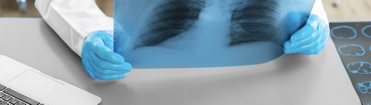 proteínas en sangre predicen la mortalidad