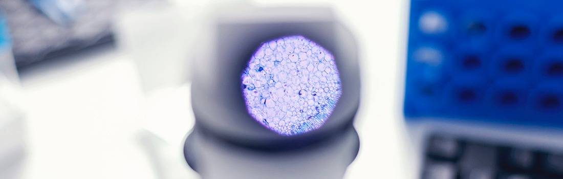 adn circulante tratamiento cáncer pulmón
