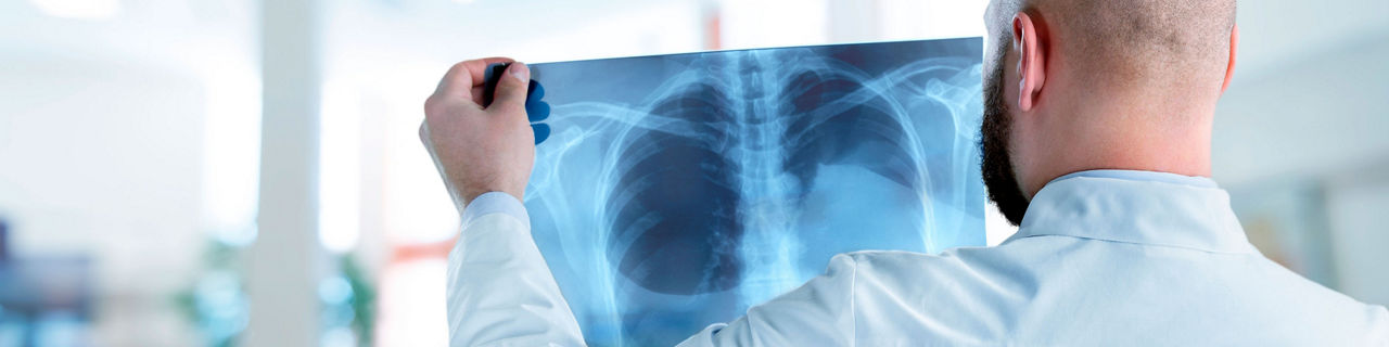 IA para detección temprana del cáncer de pulmón: revisión de radiografía de tórax
