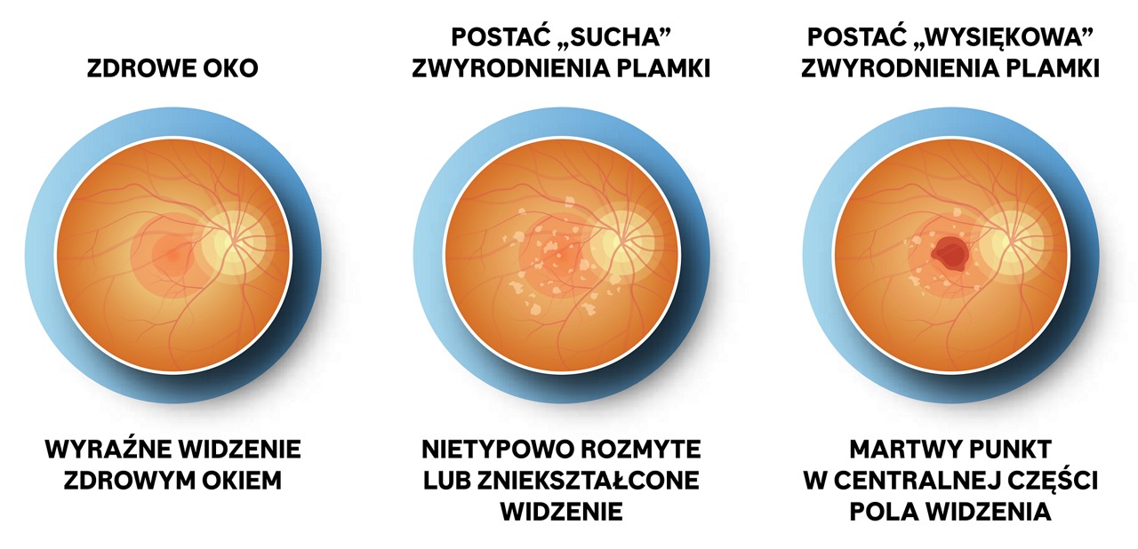 Postacie AMD