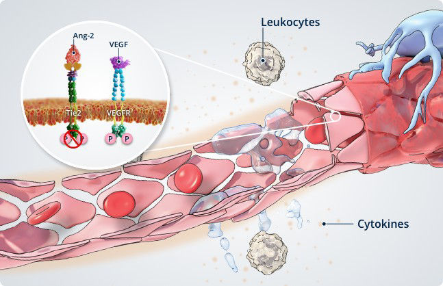 Angiopoetinele-si-instabilitatea-vasculara2.jpg