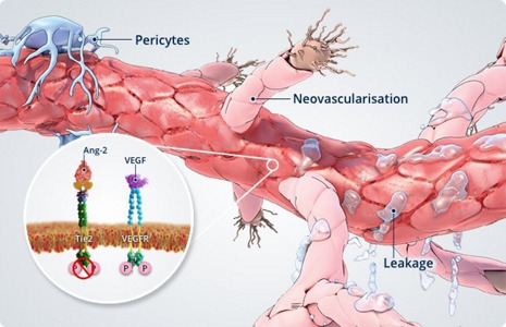 Angiopoetinele-si-instabilitatea-vasculara1.jpg