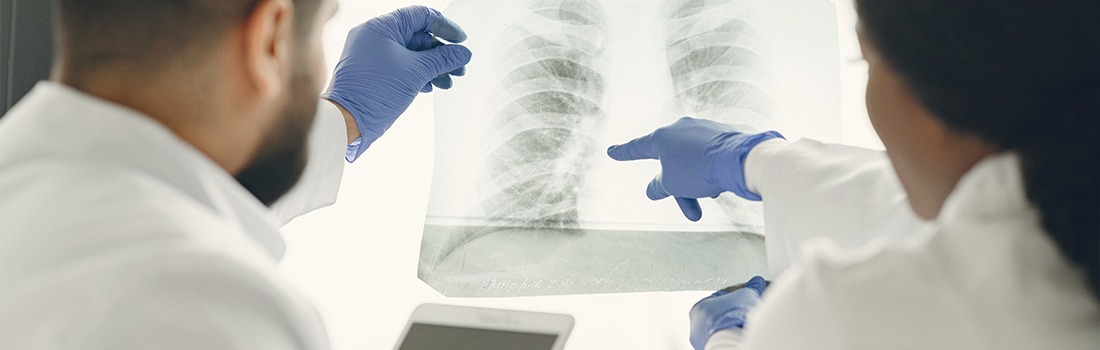 macrófagos pulmonares para frenar la metástasis