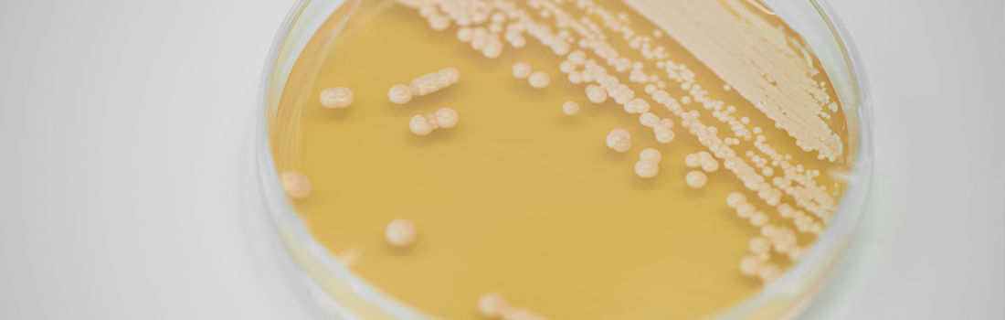 revolución genómica para cáncer de próstata