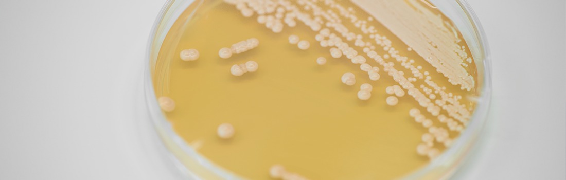 revolución genómica para cáncer de próstata