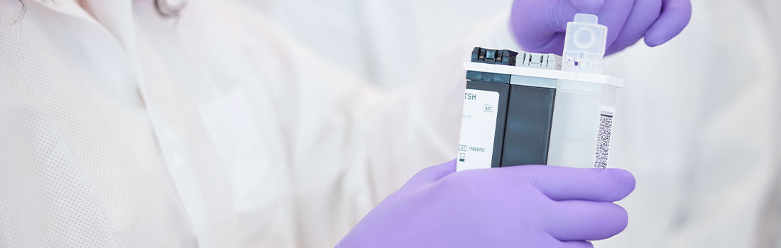 inteligencia artificial para diagnóstico displasia pulmonar prematuros