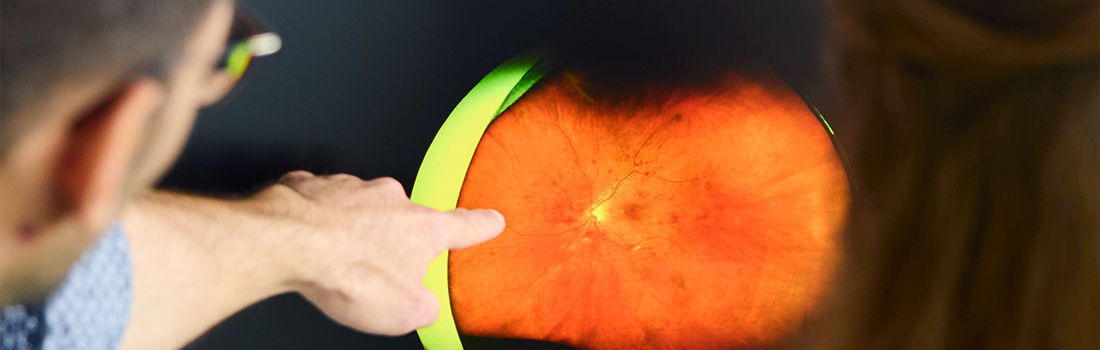 análisis de sangre para diagnosticar sarcoidosis