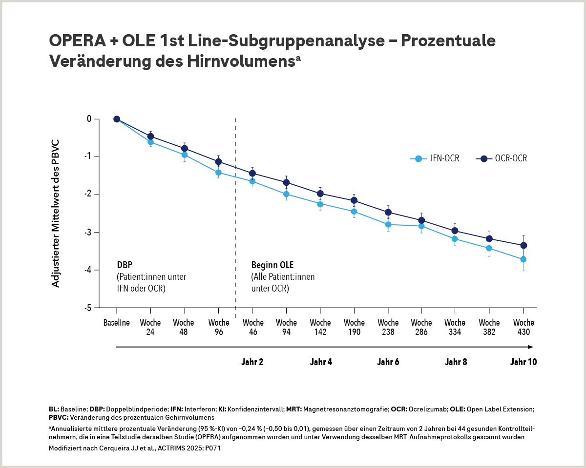 Grafik Therapieeinstieg mit Ocrevus: Prozentuale Veränderung des Hirnvolumens