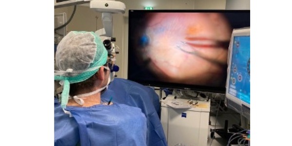 Chirurgien au bloc opératoire opérant un œil