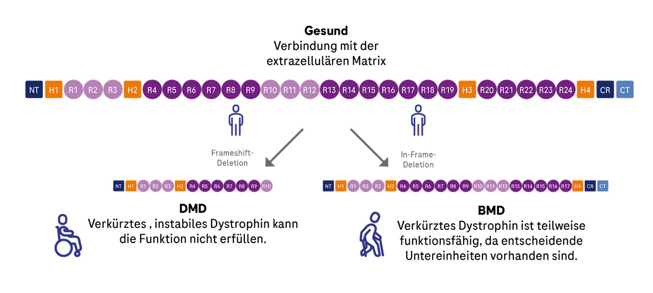 Schematische Darstellung der 24 Dystrophin-Proteinuntereinheiten eines Gesunden im Vergleich zu DMD-Patienten und BMD-Patienten.
