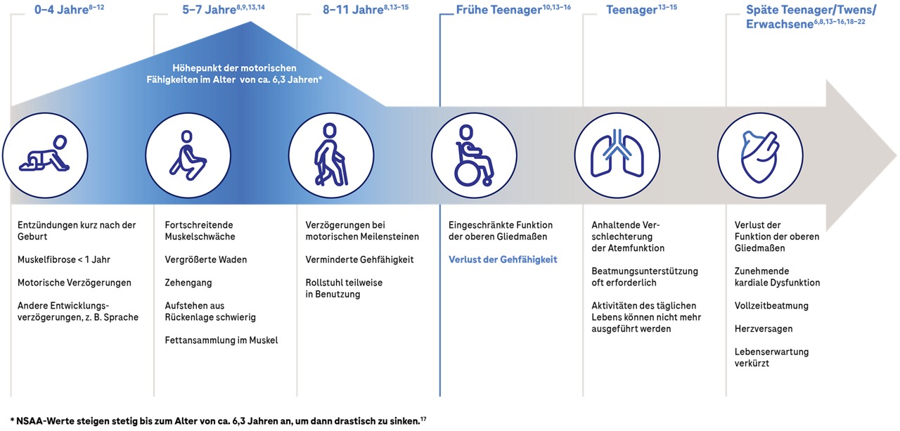 Graphische Darstellung des Krankheitsverlaufs von Duchenne-Muskeldystrophie als Zeitstrahl von Geburt bis zum Erwachsenenalter.