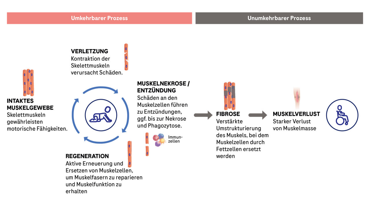 Übersicht der reversiblen (Regeneration) und irreversiblen (Fibrose) Prozesse der Muskelschädigungen bei Duchenne-Muskeldystrophie.