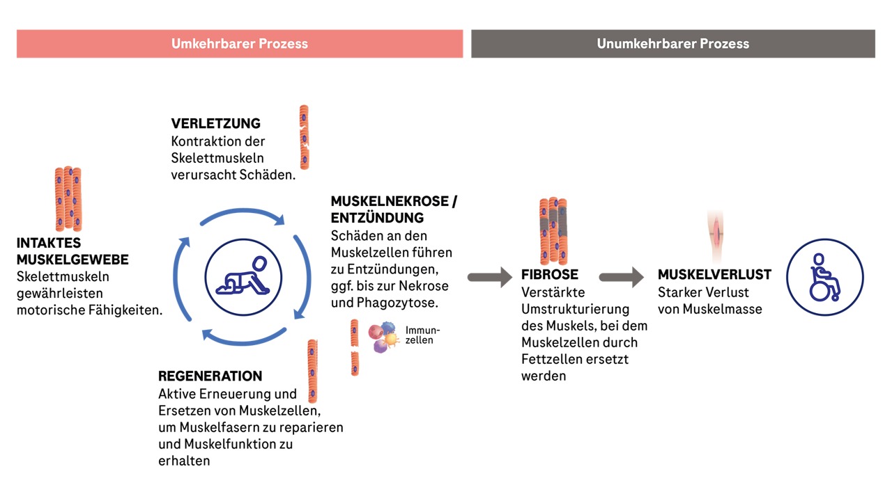 Übersicht der reversiblen (Regeneration) und irreversiblen (Fibrose) Prozesse der Muskelschädigungen bei Duchenne-Muskeldystrophie.