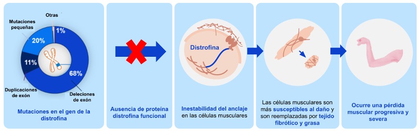 Figura 1. Mutaciones en el gen DMD e impacto en la Distrofia Muscular de Duchenne. 1–4,7