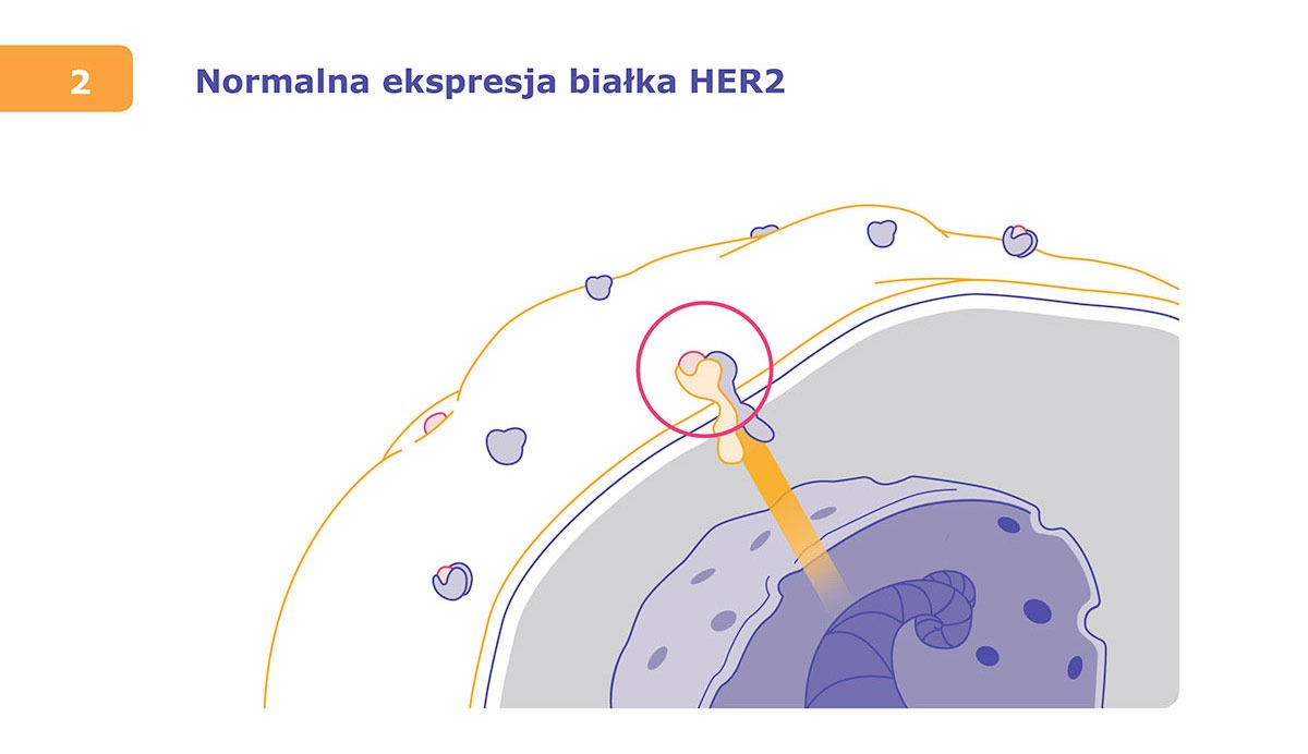 Herceptin infografikaai