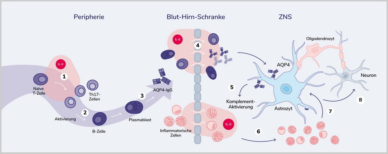 Die Pathogenese von NMOSD