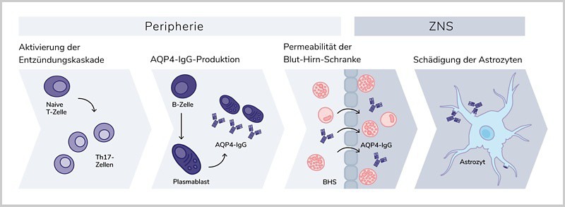 Rolle von IL-6 bei NMOSD