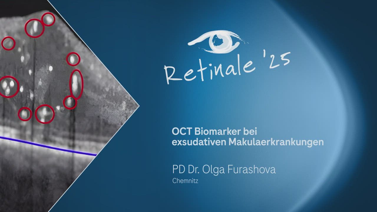 Teaserimage zu "OCT Biomarker" mit Link