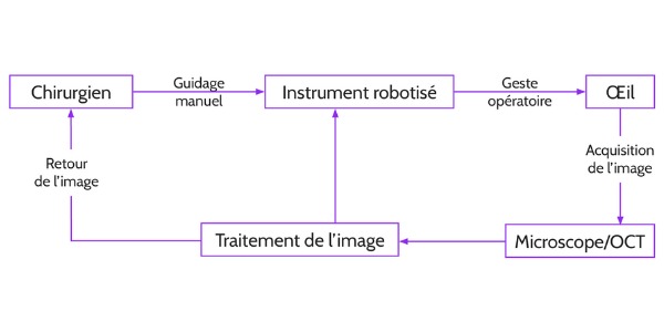 Schéma représentant le processus d’une opération avec instrument robotisé