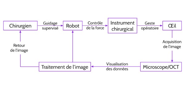 Schéma représentant le processus d’une opération avec un système entièrement ou partiellement robotisé