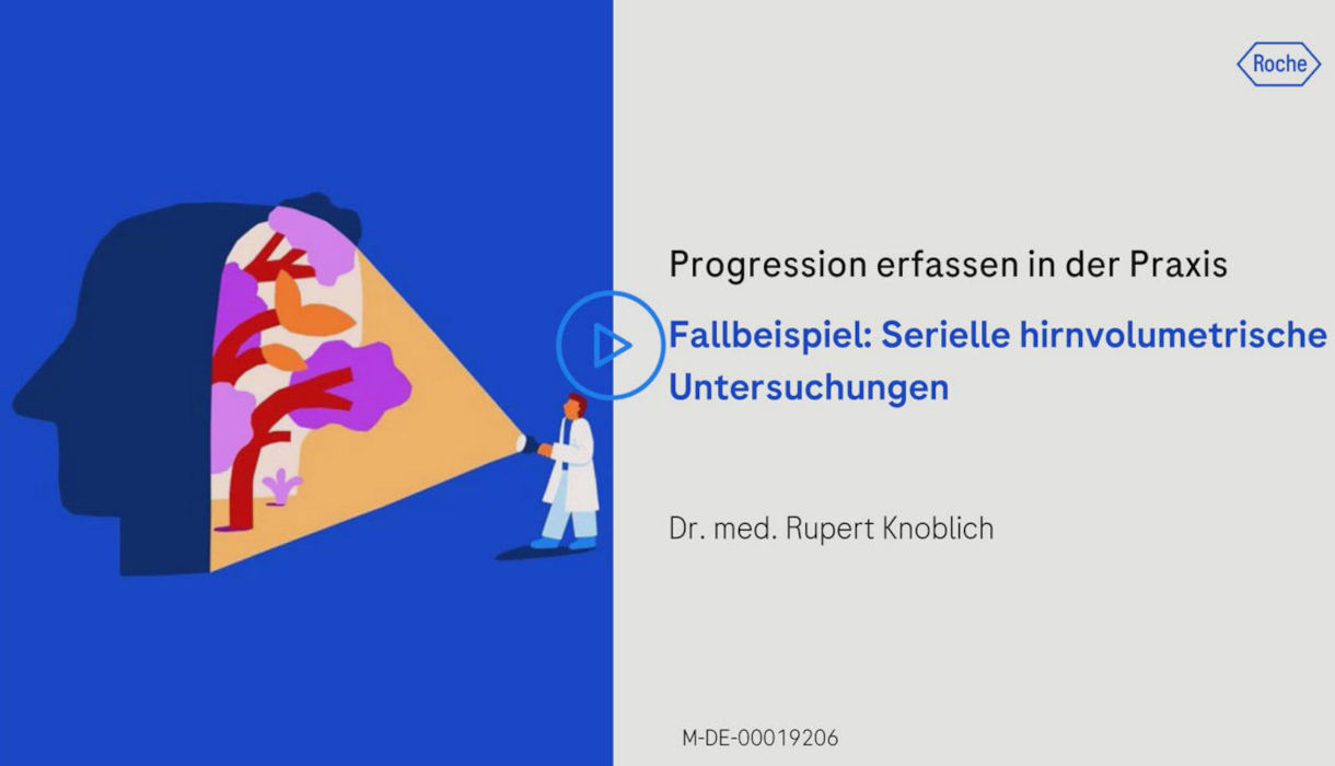 Image für Teaser "Stille MS-Progression in der Sprechstunde erkennen"