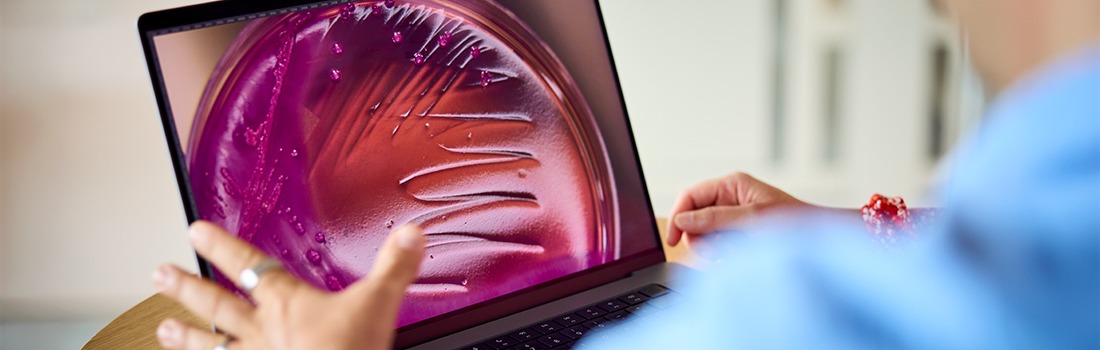 nuevas tecnologías prevención ictus