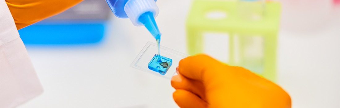adhesivo biológico fugas intervenciones quirúrgicas