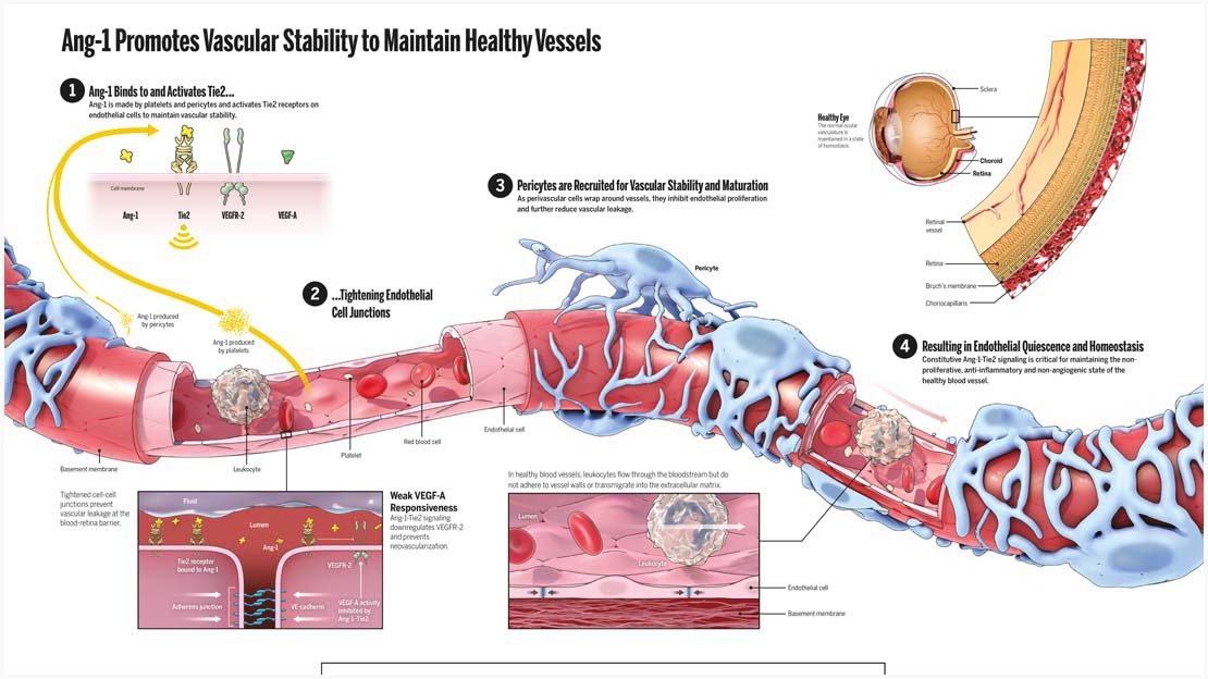 Infographic