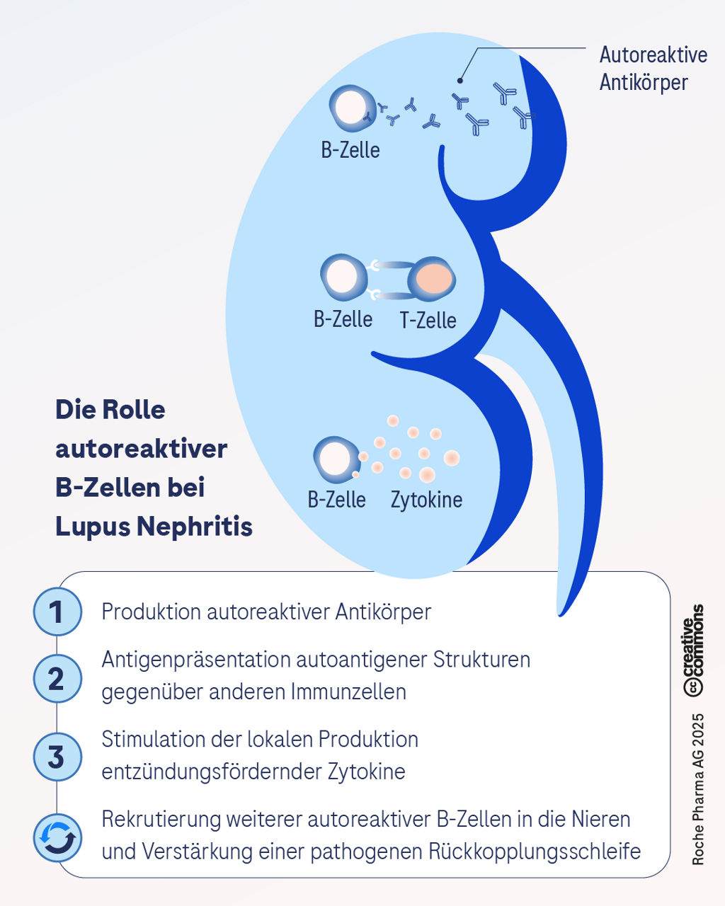 Illustration einer Niere, die die zentrale Rolle autoreaktiver B‑Zellen in der Pathogenese der Lupus Nephritis zeigt, einschließlich Produktion autoreaktiver Antikörper und Entstehung von Entzündungen.