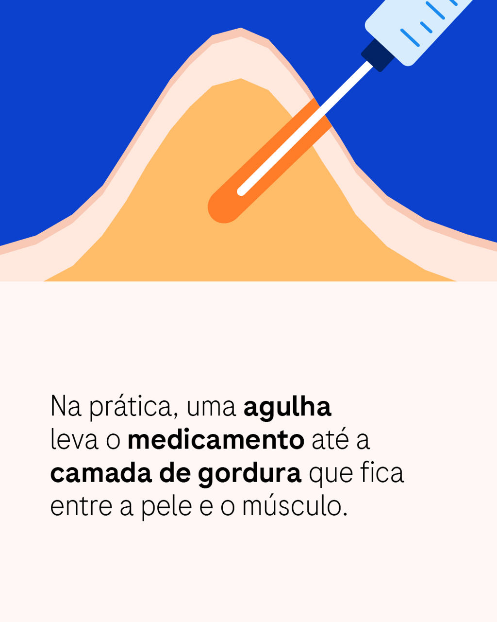Na prática, uma agulha leva o medicamento até a camada de gordura que fica entre a pele e o músculo.