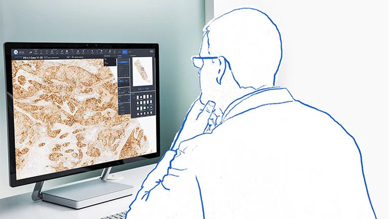  Niektoré z našich testov sú vo forme testovacích prúžkov a nevyžadujú žiadne prístroje.