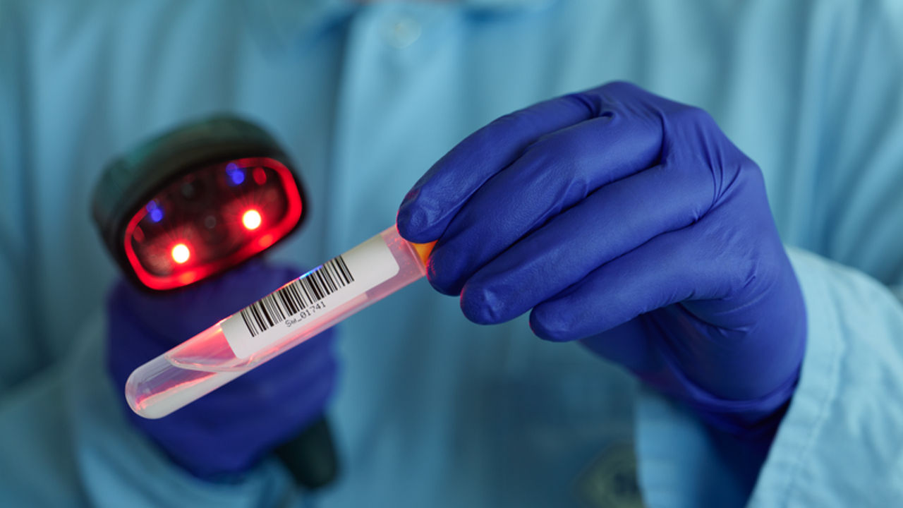 Vorbereitung diagnostischer Proben – Scannen der Probe