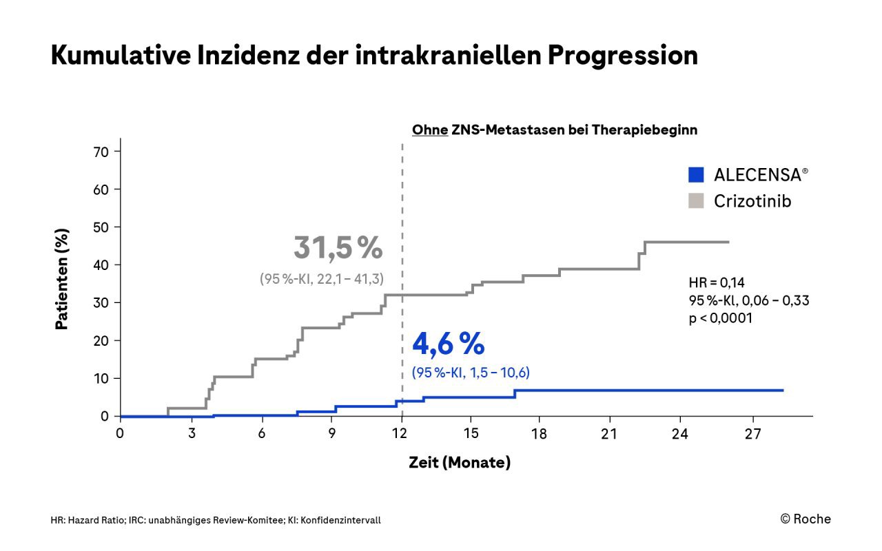 Intrakranieller Effekt unter Alectinib bei Patienten ohne ZNS-Metastasen bei Therapiebeginn