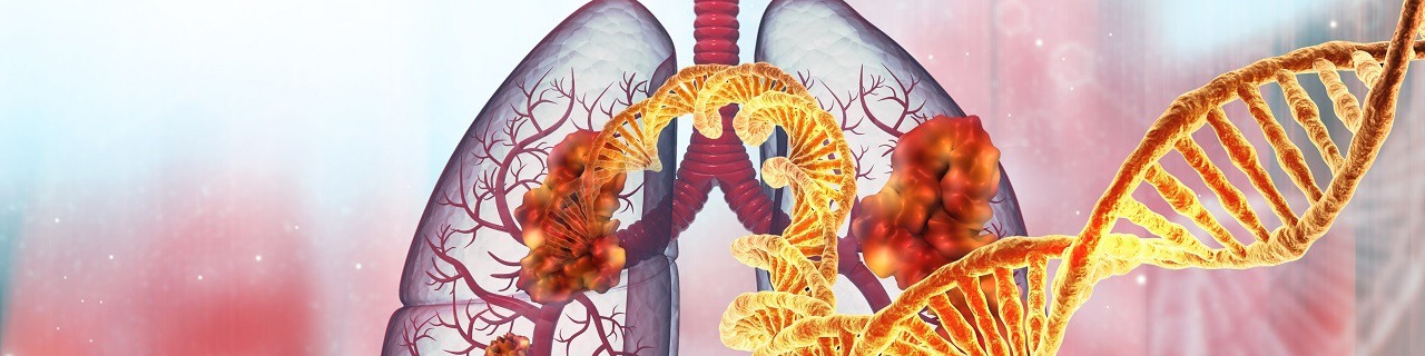 Human lung cancer with dna strand. 3d illustration	