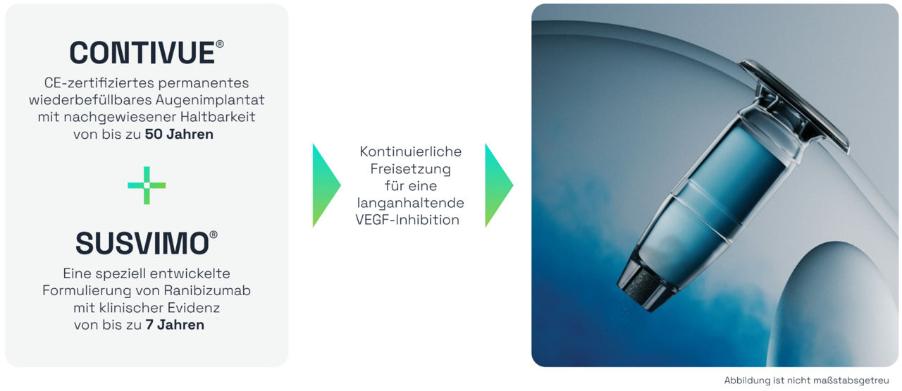 Contivue Susvimo Überblick: Infografik, die die Kombination aus dem Augenimplantat Contivue und der Wirkstoffformulierung Susvimo zeigt, welche zusammen eine kontinuierliche Freisetzung für eine langanhaltende VEGF-Inhibition ermöglichen, ergänzt durch eine 3D-Darstellung des Implantats.