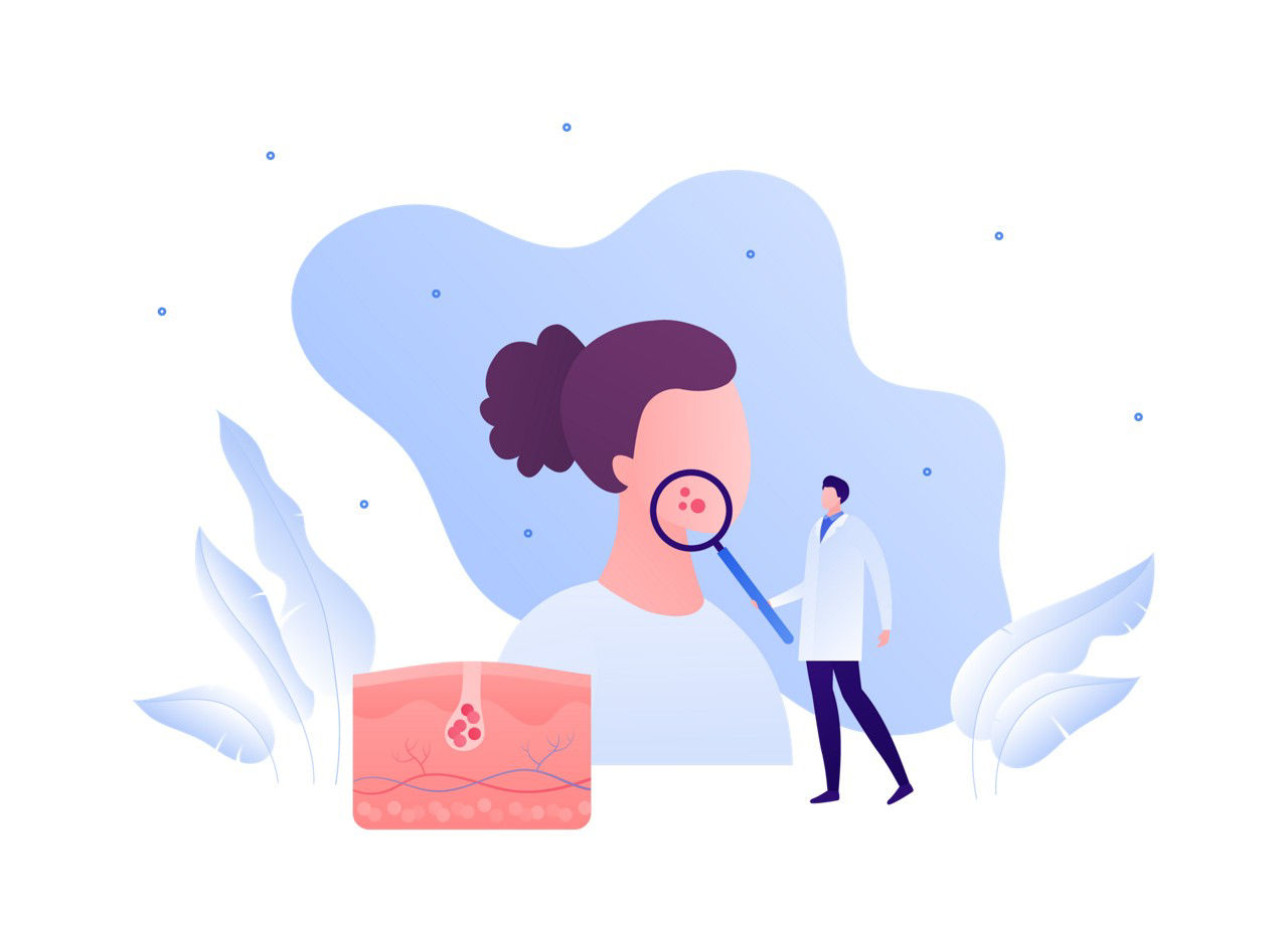 Cáncer de piel ilustración