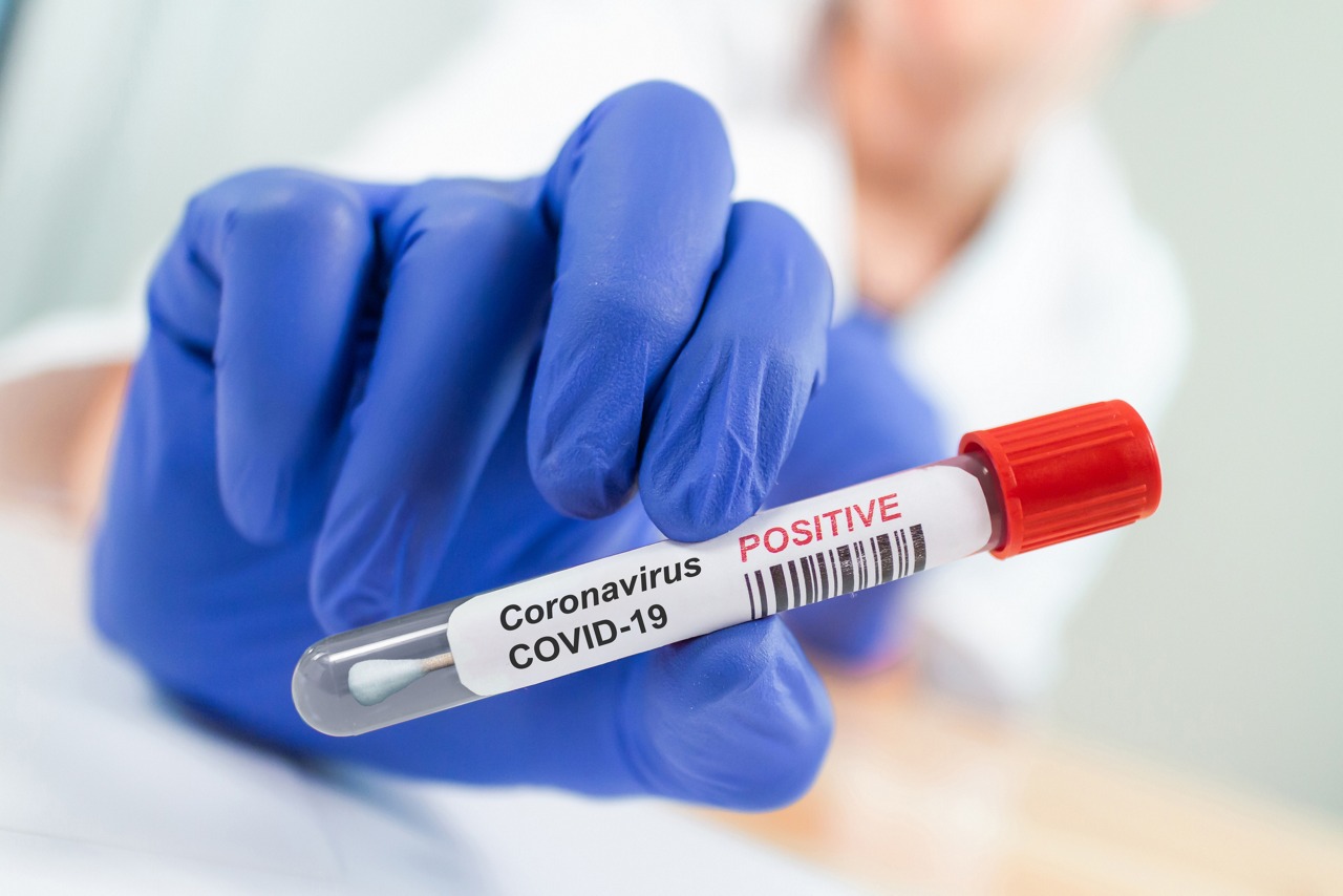 Coronavirus Infected Swab Test Sample in Doctor Hands. COVID-19 Epidemic and Virus Outbreak.