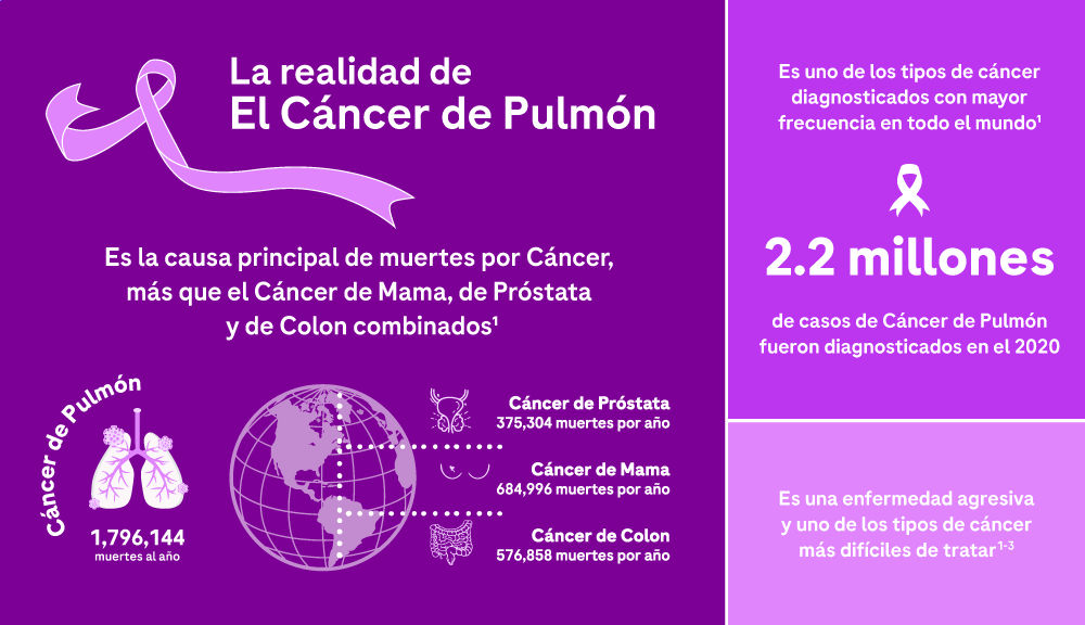 Iinfografía que resume la realidad del cáncer de pulmón en el mudo como principal causa de muertes por cáncer y diagnóstico con mayor frecuencia