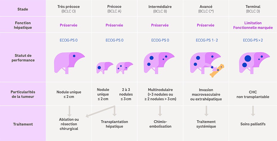 système bclc classifiant les 5 stades des CHC
