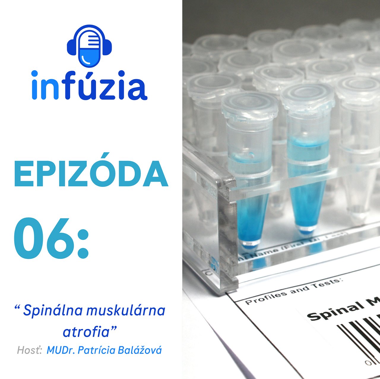 Epizóda 6: Spinálna muskulárna atrofia