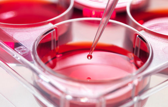 Pipette adding sample to stem cell cultures growing in pots, Used to implant stem cells to repair damaged tissues