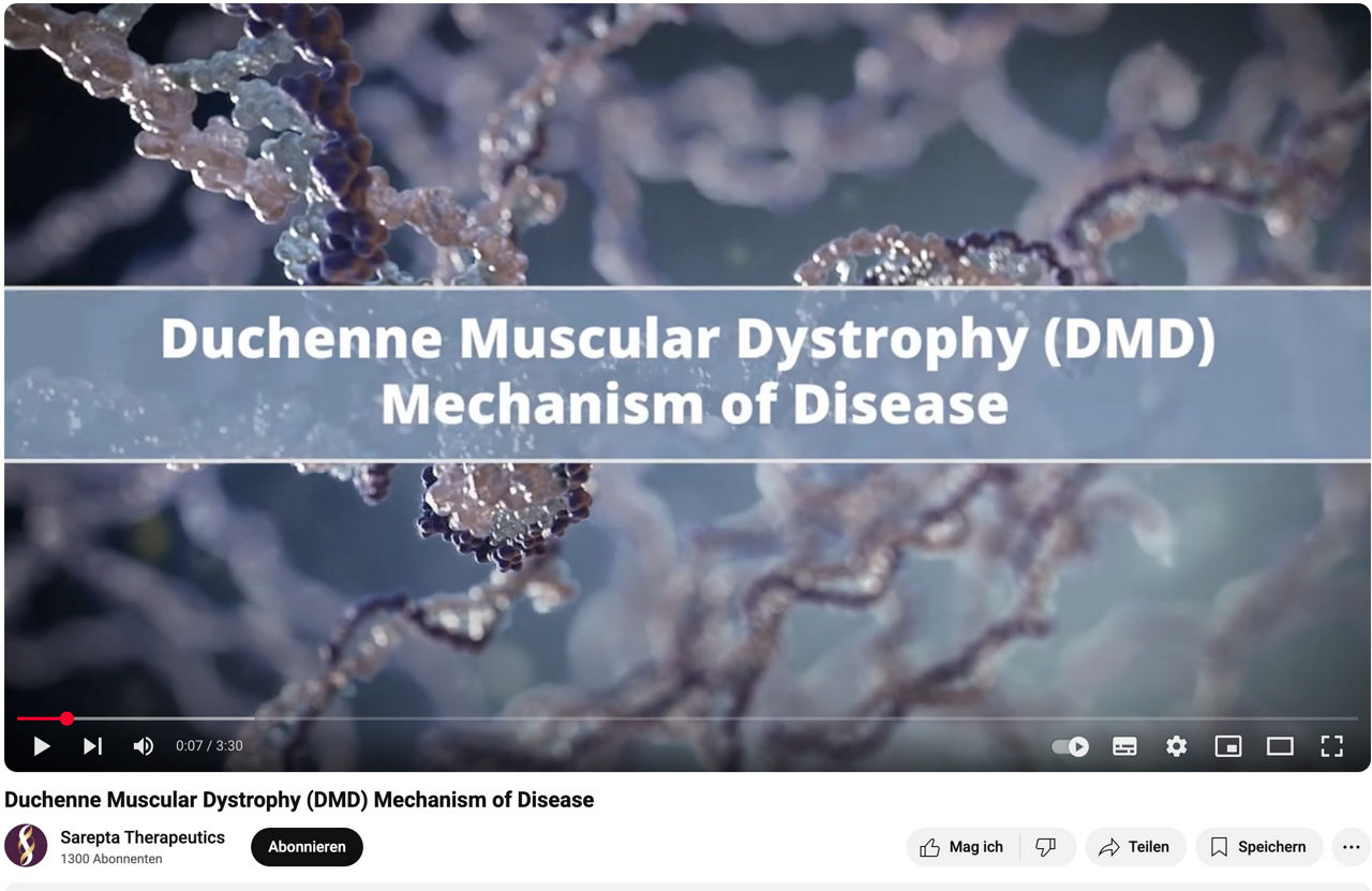 Screenshot des Videos zu Duchenne muscular dystrophy (DMD) mechanism of disease