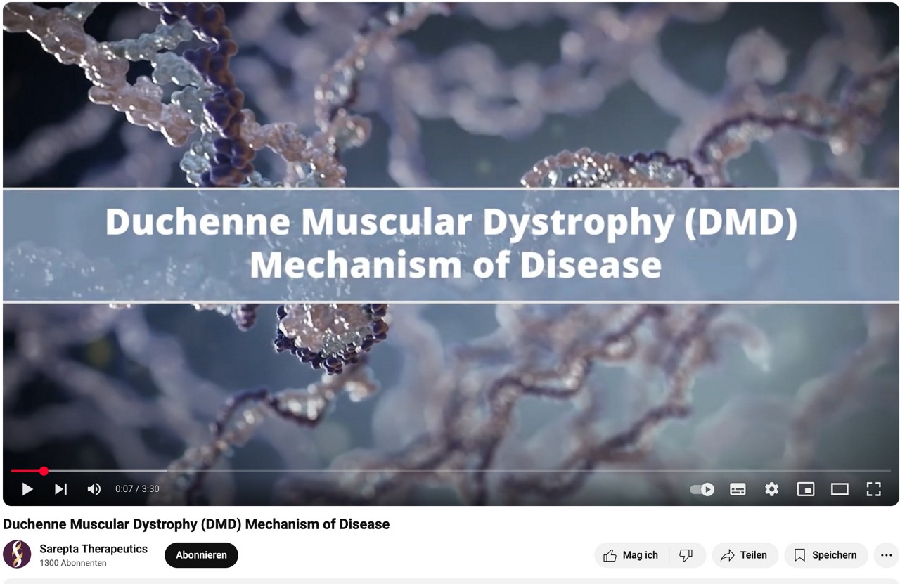 Screenshot des Videos zu Duchenne muscular dystrophy (DMD) mechanism of disease
