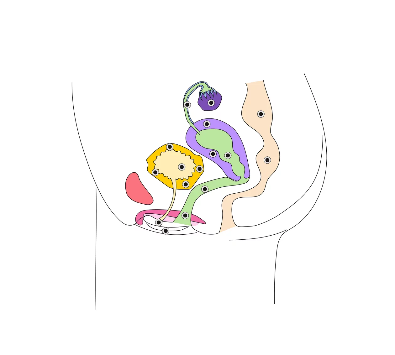 Illustration Endometriose