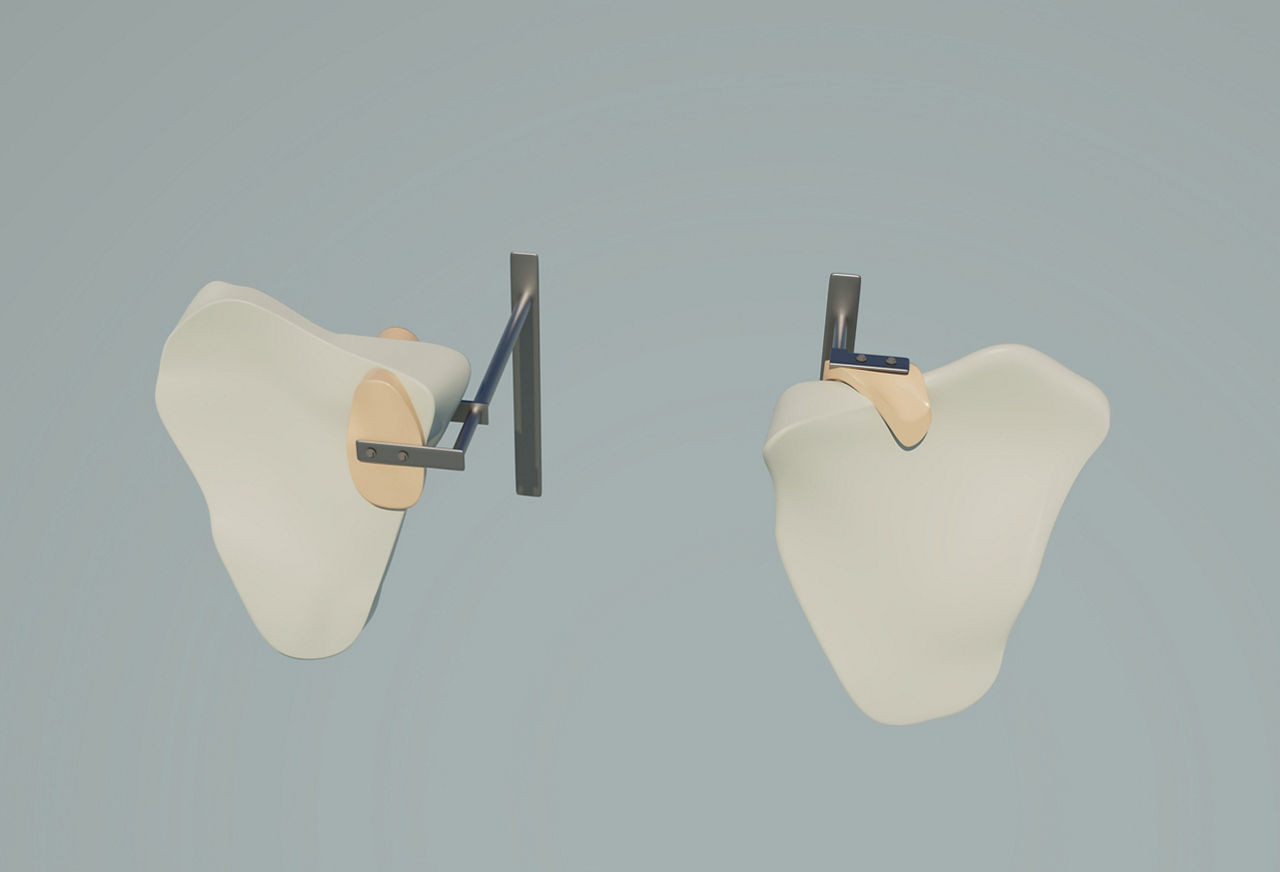 Visualisierung Schutzfläche hinten und vorne