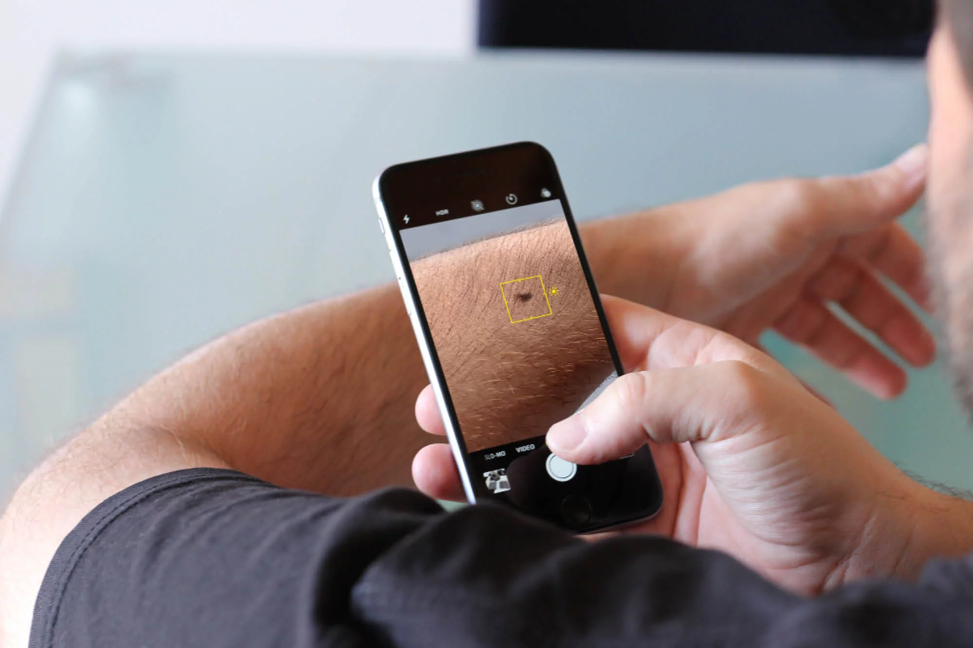 Mann fotografiert sein Muttermal welches er an derma2go sendet