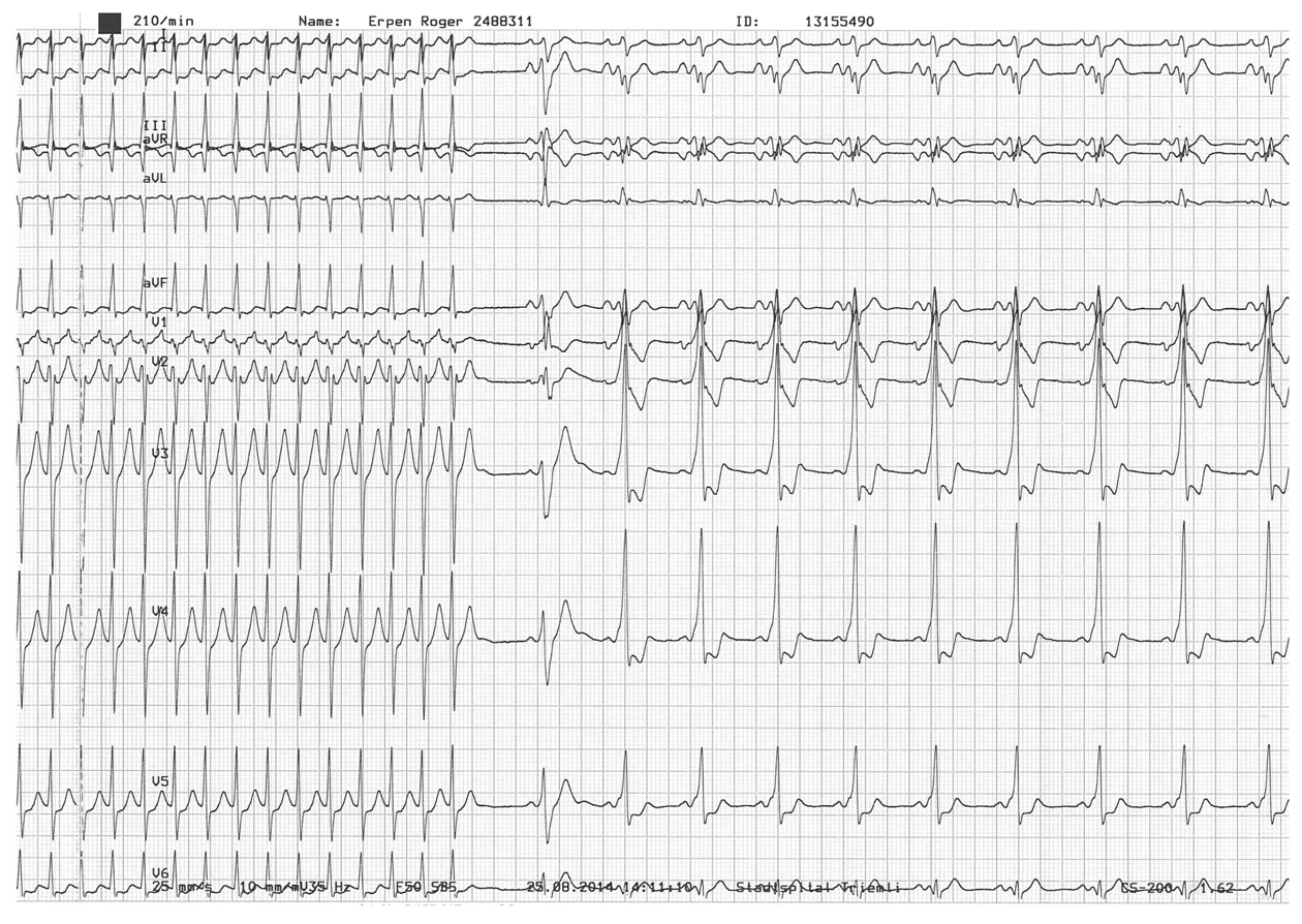 EKG-Bild